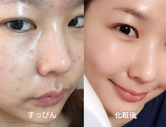 BA画像